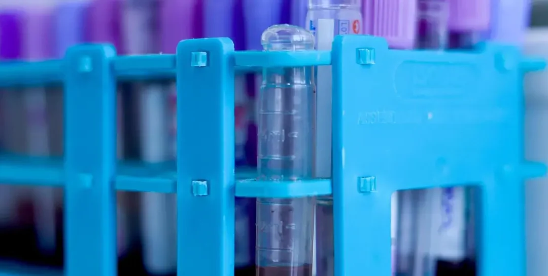 Investigación liderada por Bolivia identifica gen que da una mejor adaptación a la altitud