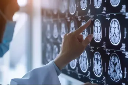Primer paciente del mundo sometido a una cirugía cerebral asistida por IA en tiempo real